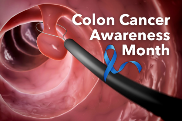 Colorectal Cancer Awareness Month:  What You Need to Know About Screening and Prevention